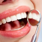 Implantul dentar: cea mai buna solutie pentru refacerea dintilor lipsa