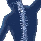 Cum tratam problemele coloanei vertebrale?